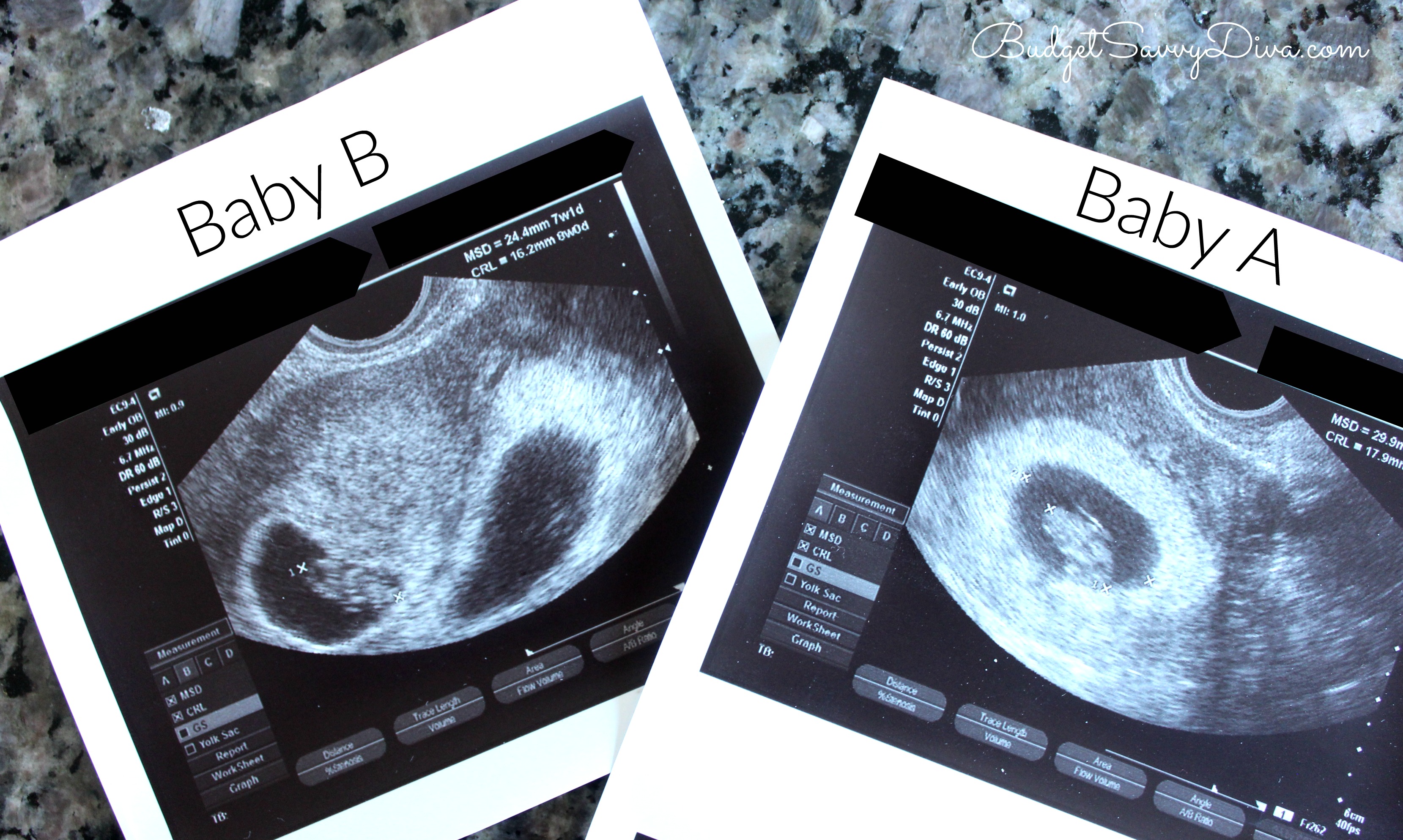 8 week ultrasound identical twins