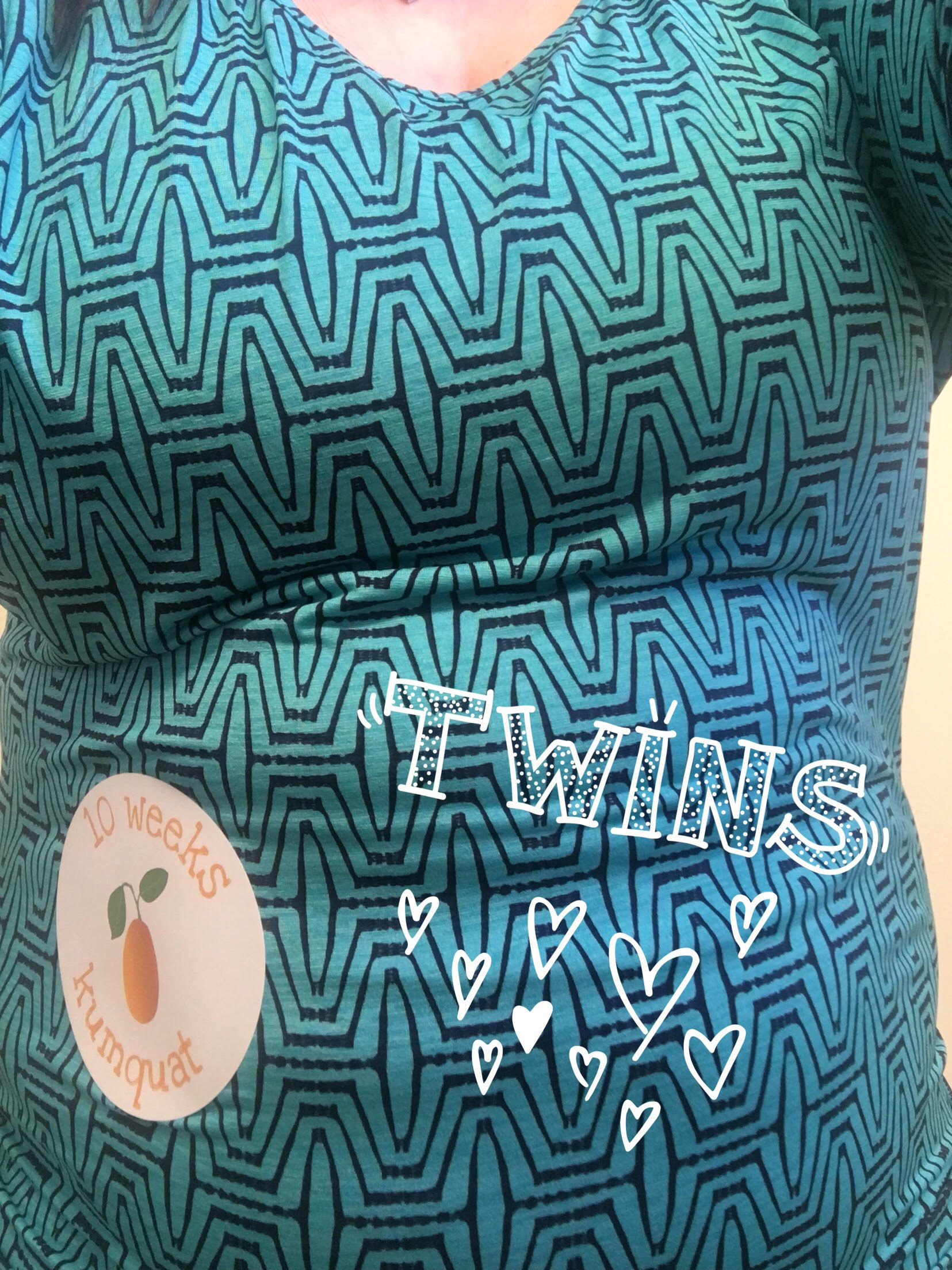 10 weeks pregnant with twins bump